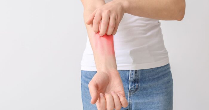 Alergeny jsou látky, které mohou v lidském organismu vyvolat alergickou reakci. Alergická reakce se může projevit na kůži, respiračními symptomy nebo problémy spojenými s trávicím systémem.