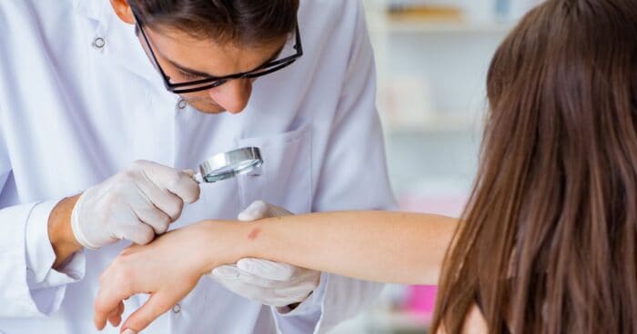 Při léčbě alergie na kosmetiku je důležité dodržovat všechny pokyny lékaře. V akutní fázi se používají kortikoidní krémy, základem je ale promazávání a eliminace alergenu.