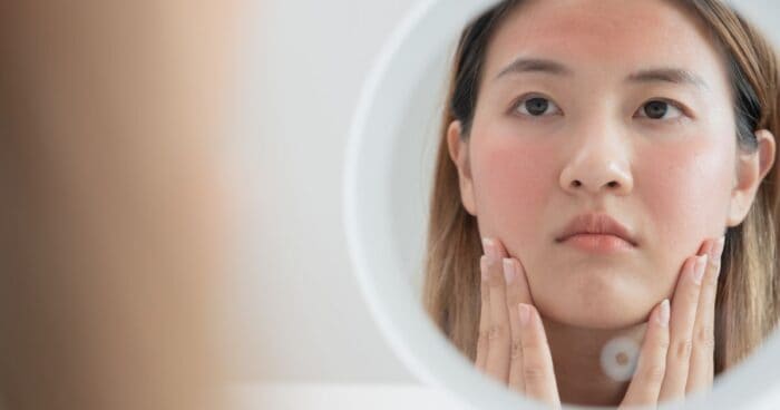 Alergie na kosmetiku se může u každého projevit trochu jiným způsobem nebo v jiné intenzitě. Mezi nejčastější projevy alergie na kosmetiku ale patří zarudnutí a svědění pokožky, vyrážka, otoky, suchá a loupající se kůže.