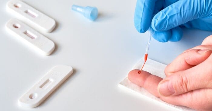 alergie na latex — Testování na alergii na latex předchází důkladná anamnéza. Následné testy mohou mít dvojí podobu. Pr
