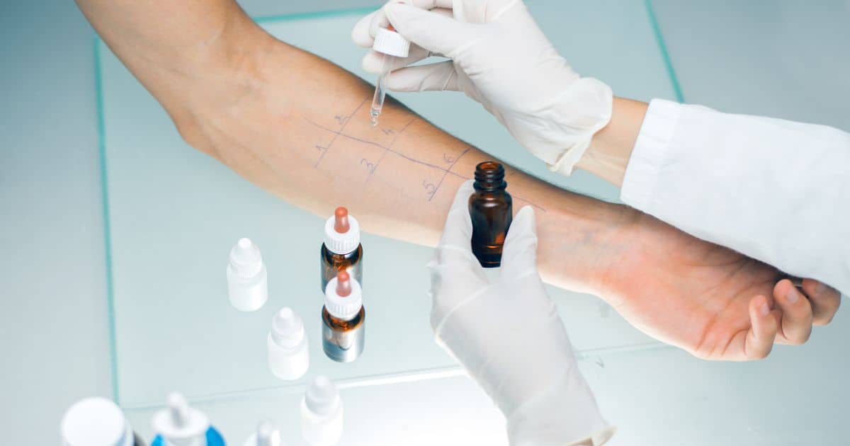 Počítejte s tím, že opět nejprve provede test. Ten se ale nebude týkat jen alergie na zvířata, ale i dalších typů alergií. Buď půjde o odběr krve, nebo kožní testy, v jejichž rámci dochází k aplikaci malého množství alergenu na kůži a následně se sleduje, jak pokožka na alergeny reaguje.