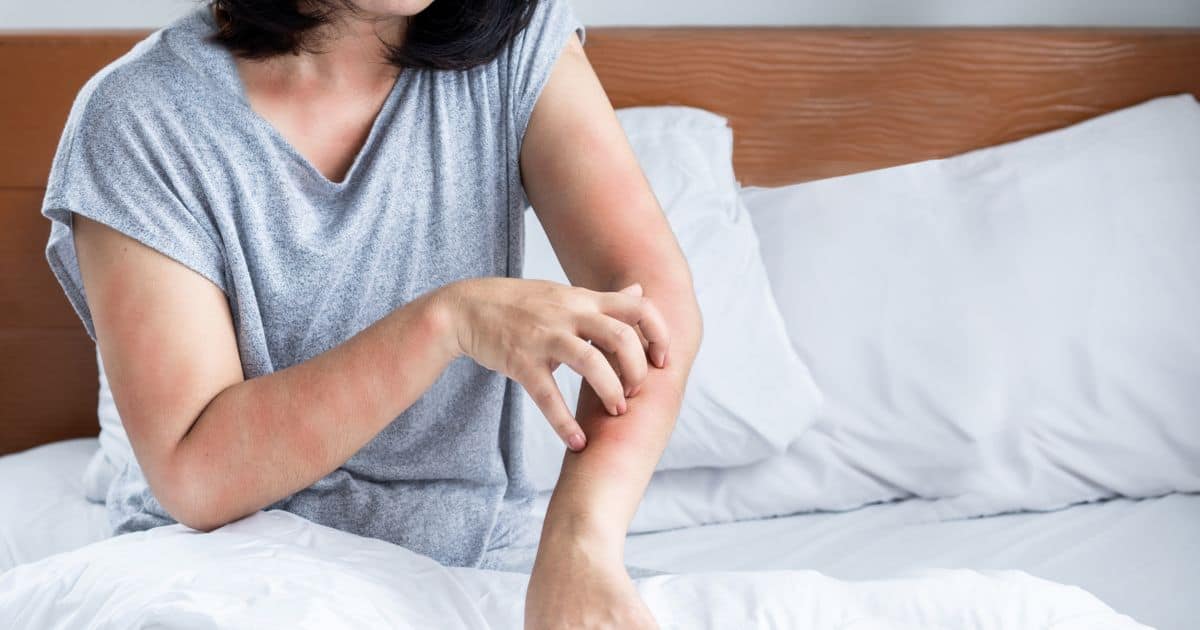 Mezi nejčastější příznaky alergie na prací prášek ale patří svědění kůže, vyrážka, zčervenání či loupání kůže, někdy dokonce otok.